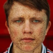 Парень с веснушками на фоне красной стены